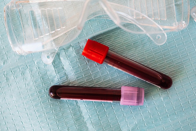 What is the Normal Range for an EGFR Blood Test?